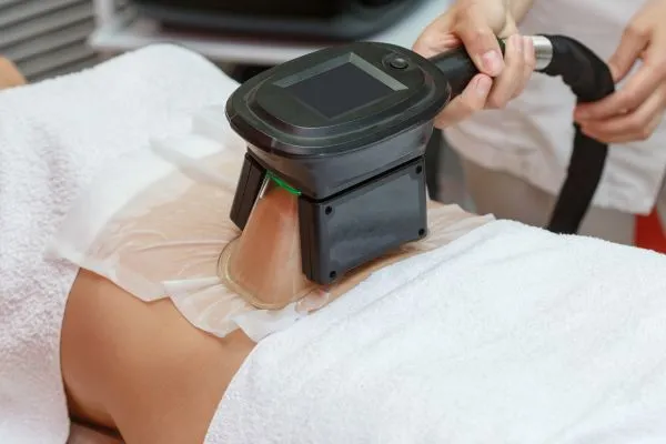 Image of person having fat freezing treatment to help weight gain Chatham