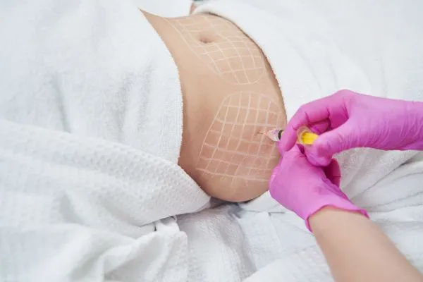 image of fat dissolving injections on love handles to help combat weight gain Chatham