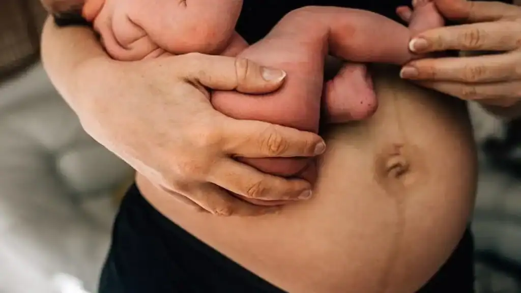 Why Is My Stomach Still Big After Pregnancy Chatham?