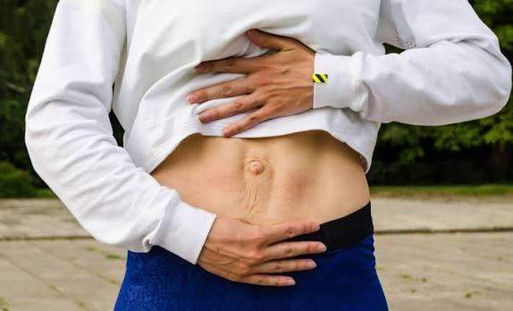 When Could Diastasis Recti Be the Missing Piece of the Puzzle Chatham?